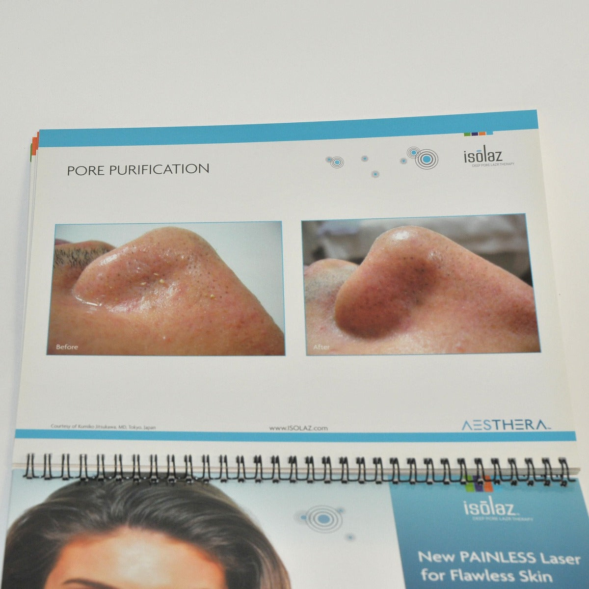 Aesthera Isolaz LASER Office Marketing Consulting Before After Brochure Book