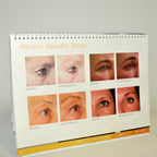 Ultherapy Consultation Patient Marketing Face Wrinkles Office Treatment Photos