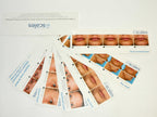 Merz SCALES Patient Face Hands Jowls Photos Diagnostic Comparison Office Consult
