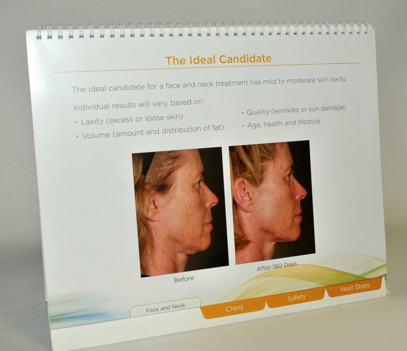 Ulthera Ultherapy PATIENT CONSULTATION Consulting Office Marketing Employee Help