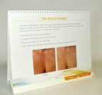 Ulthera Ultherapy PATIENT CONSULTATION Consulting Office Marketing Employee Help