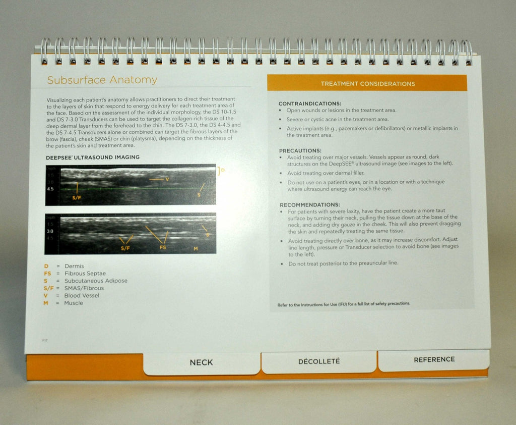 Ulthera Ultherapy Patient Treatment Reference Guidelines Guide Operator Training