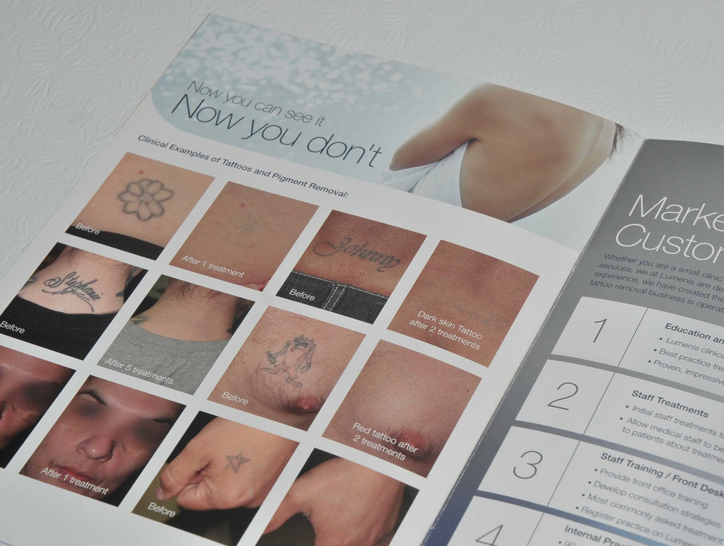 Lumenis PiQo4 Laser Tattoo Removal Patient Office Marketing Brochure PiQ04 x9Pcs
