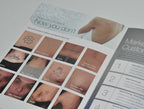Lumenis PiQo4 Laser Tattoo Removal Patient Office Marketing Brochure PiQ04 x9Pcs