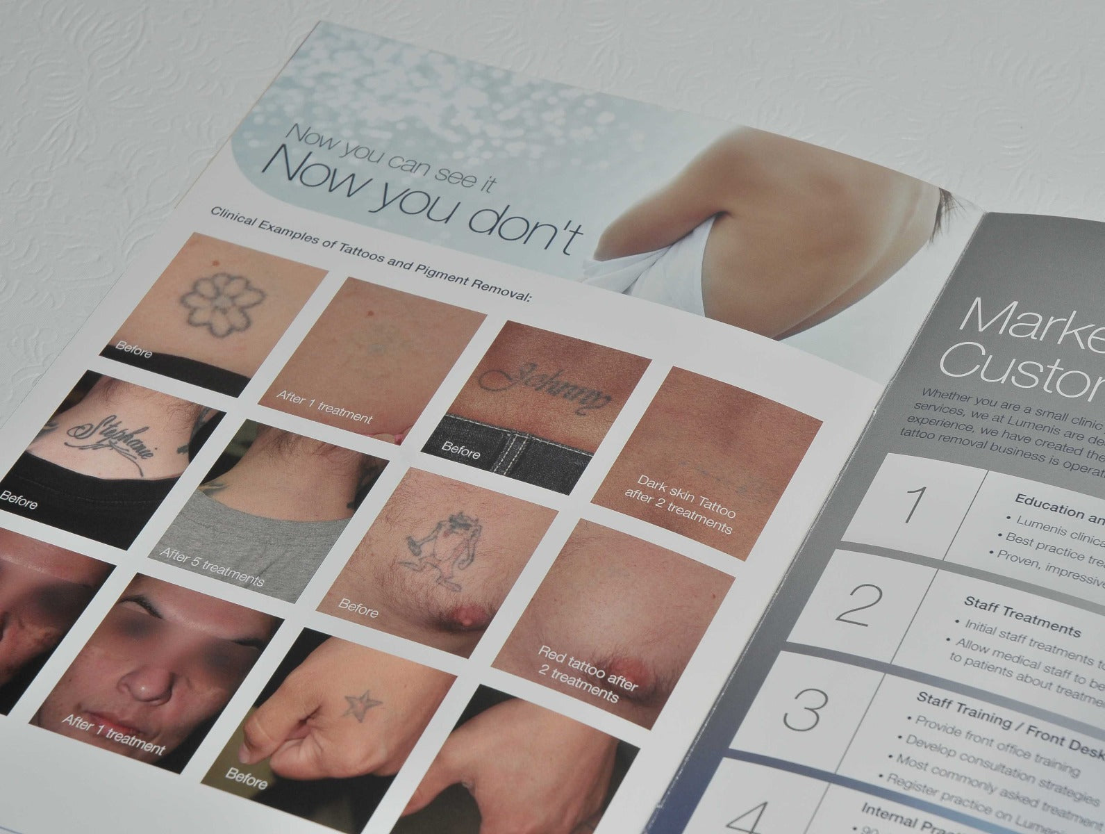Lumenis PiQo4 Laser Tattoo Removal Patient Office Marketing Brochure PiQ04 x9Pcs