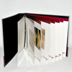 Fraxel Dual 1550 1927 Patient Before After Treatment Photo Office Marketing Book