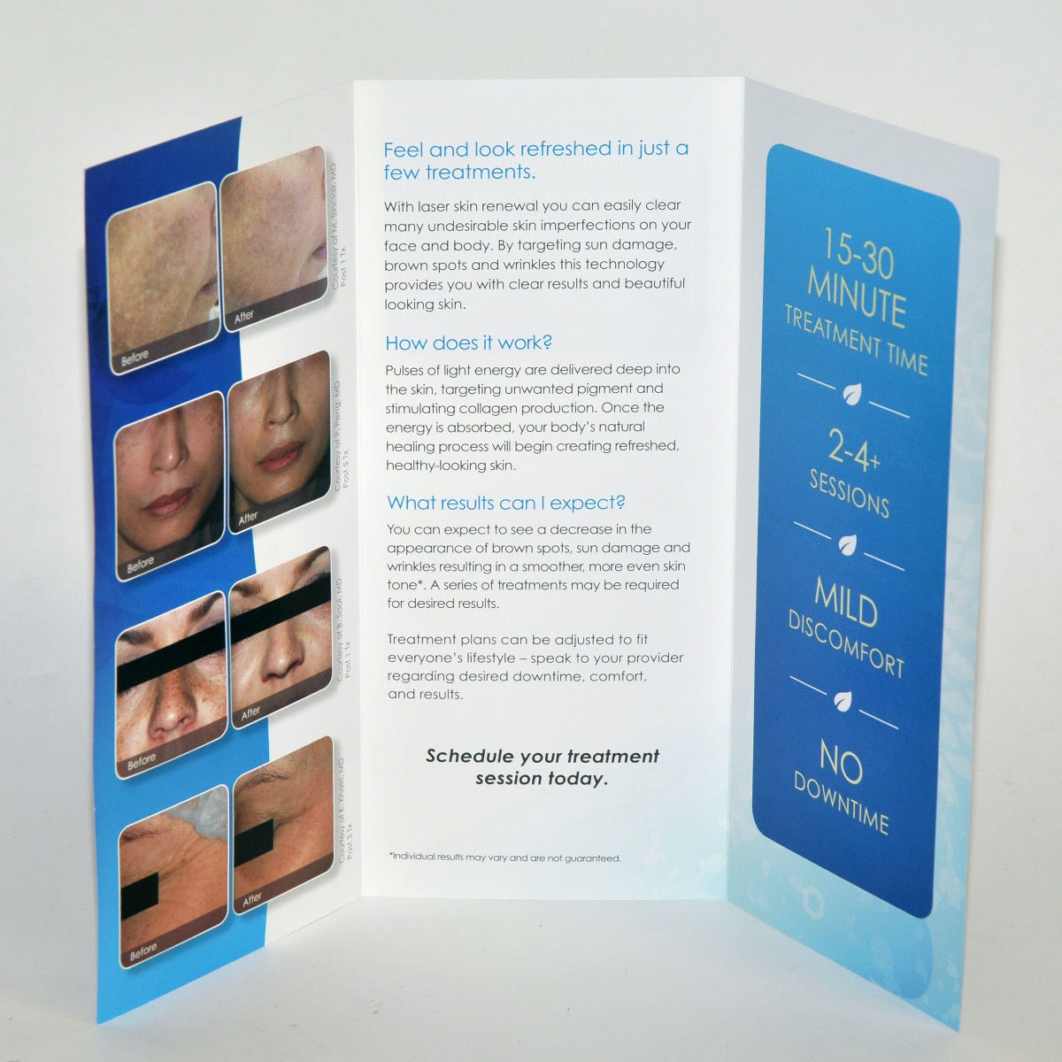Cynosure Laser Skin Renewal Patient Brochure Information age spot wrinkle 33 PCS