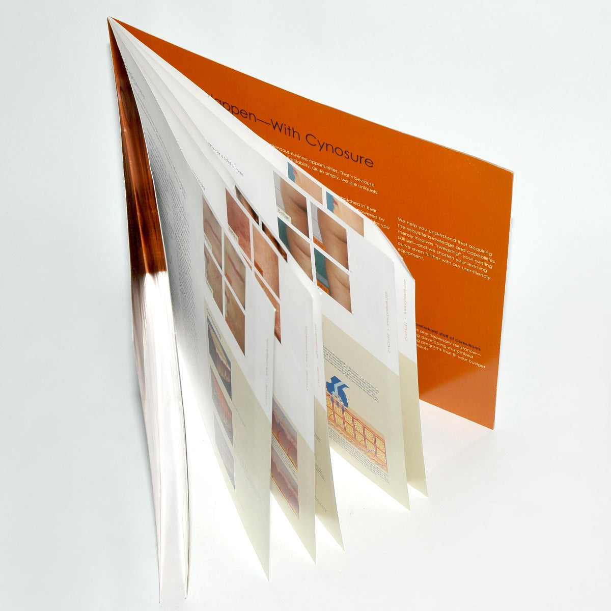 Cynosure Laser TOOLS OF TRANSFORMATION Sales Brochure Affirm SmartLipo Elite