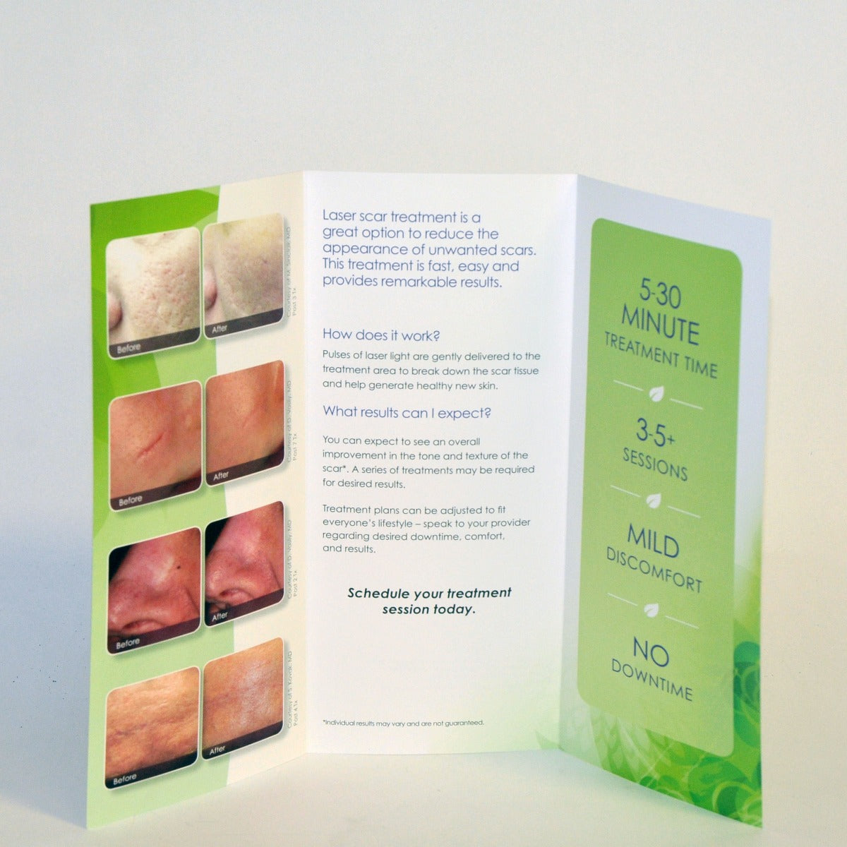 Cynosure Feel Confident IPL Laser Scar Removal Office Patient Brochures BULK