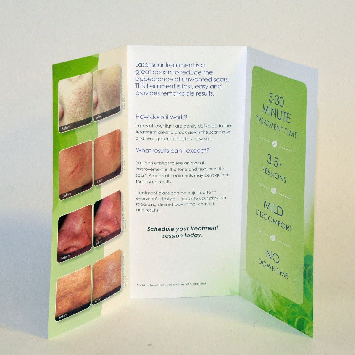 Cynosure Feel Confident IPL Laser Scar Removal 921-0621-000 Brochures x18 Pcs