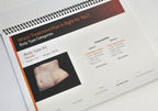 Cynosure SculpSure Laser YOUR SCULPSURE TREATMENT Patient Consultation Guide