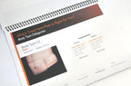 Cynosure SculpSure Laser YOUR SCULPSURE TREATMENT Patient Consultation Guide