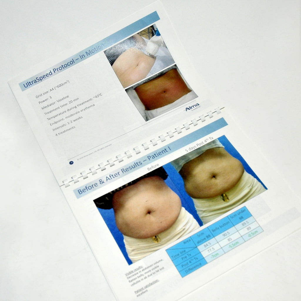 Alma Lasers Accent Prime Clinical Application Promo Booklet Sales Brochure Guide