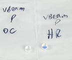 Candela VBeam or Perfecta OC Replacement HR Optics Mix Particle 8001-00-0002 Set