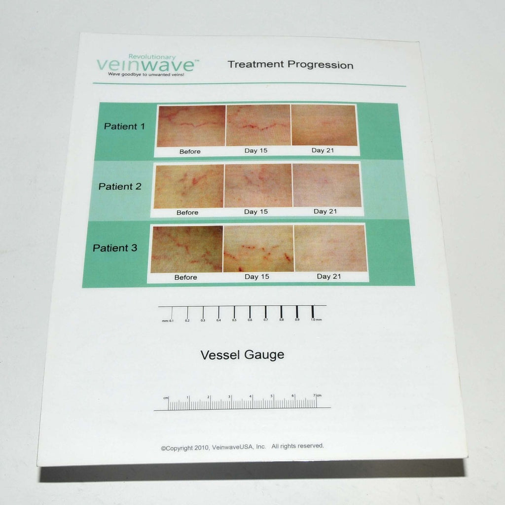 Revolutionary VeinWave Treatment Progression Photos Chart Vessel Gauge FAQ Sheet