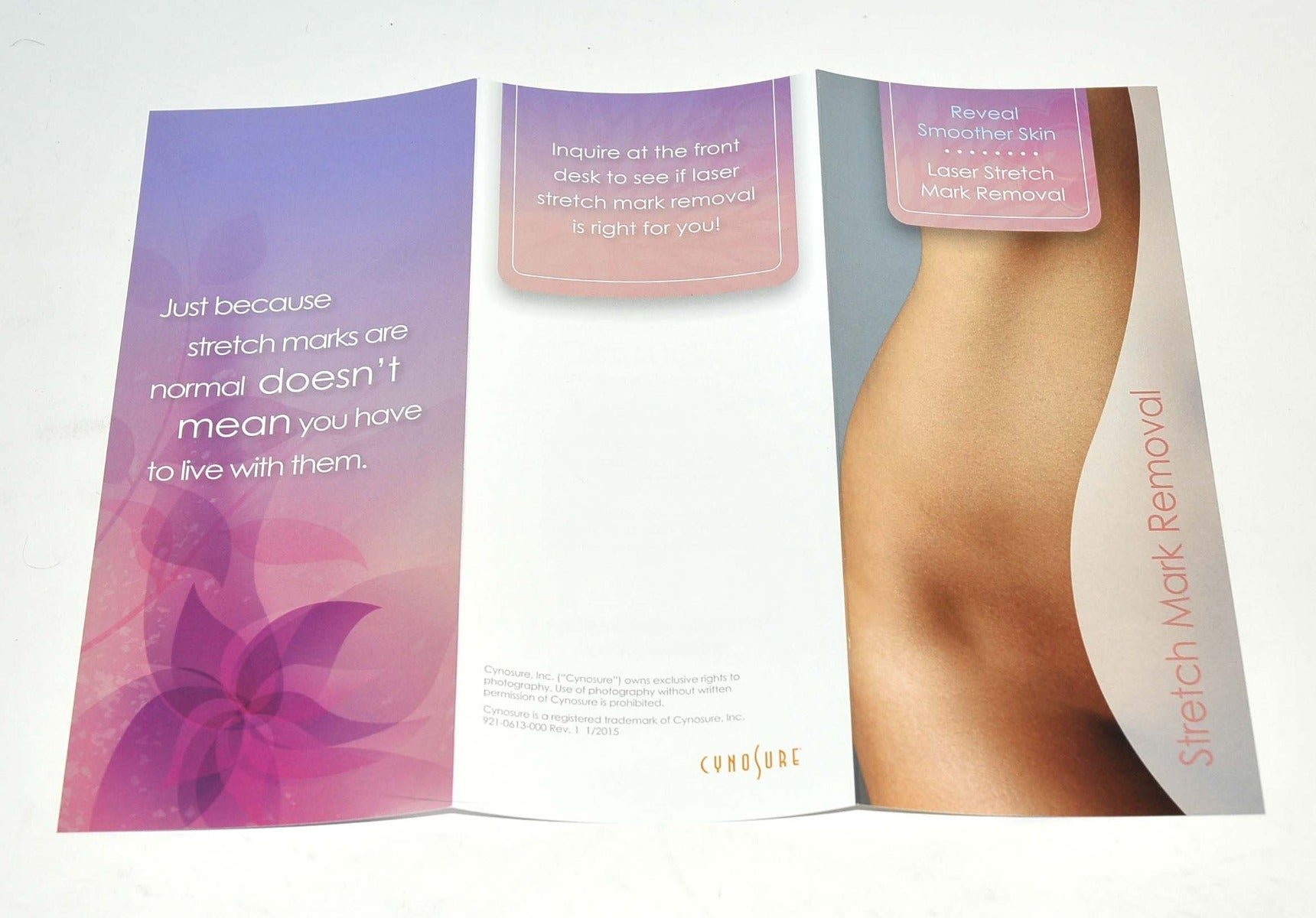 Cynosure ICON Laser Smooth Skin Stretch Mark Removal Patient Brochure x25Pcs
