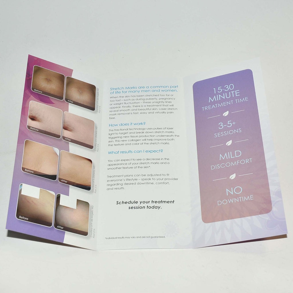 Cynosure ICON Laser REVEAL SMOOTHER SKIN Stretch Mark Removal Brochure x20Pcs