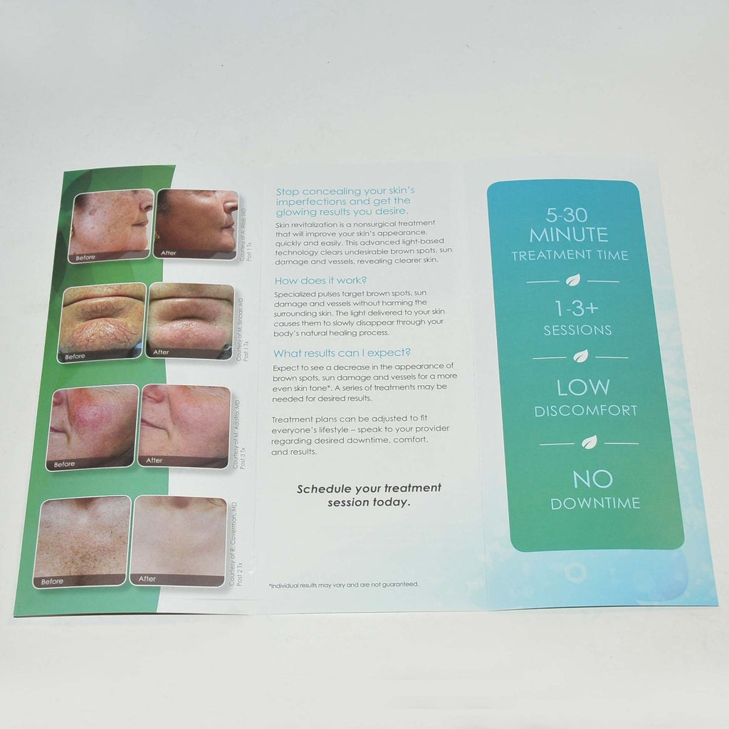 Cynosure Laser Skin Revitalization Patient Brochure x72 Pcs
