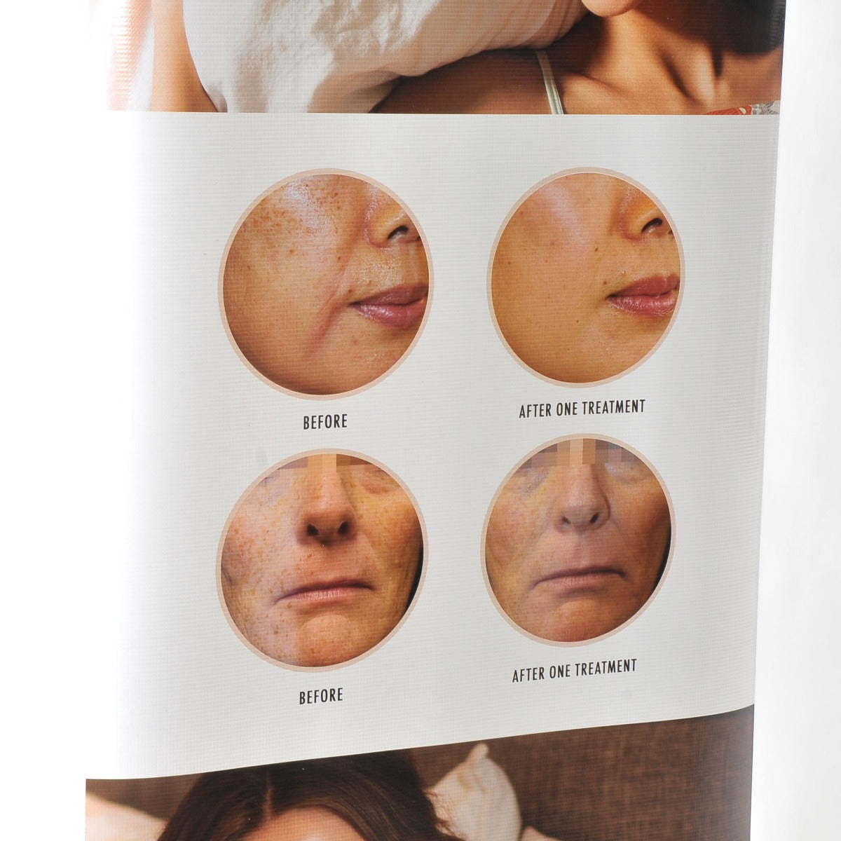 PICO Genesis Marketing Banner WAKE UP CONFIDENT Treatment Office Trade 24x82