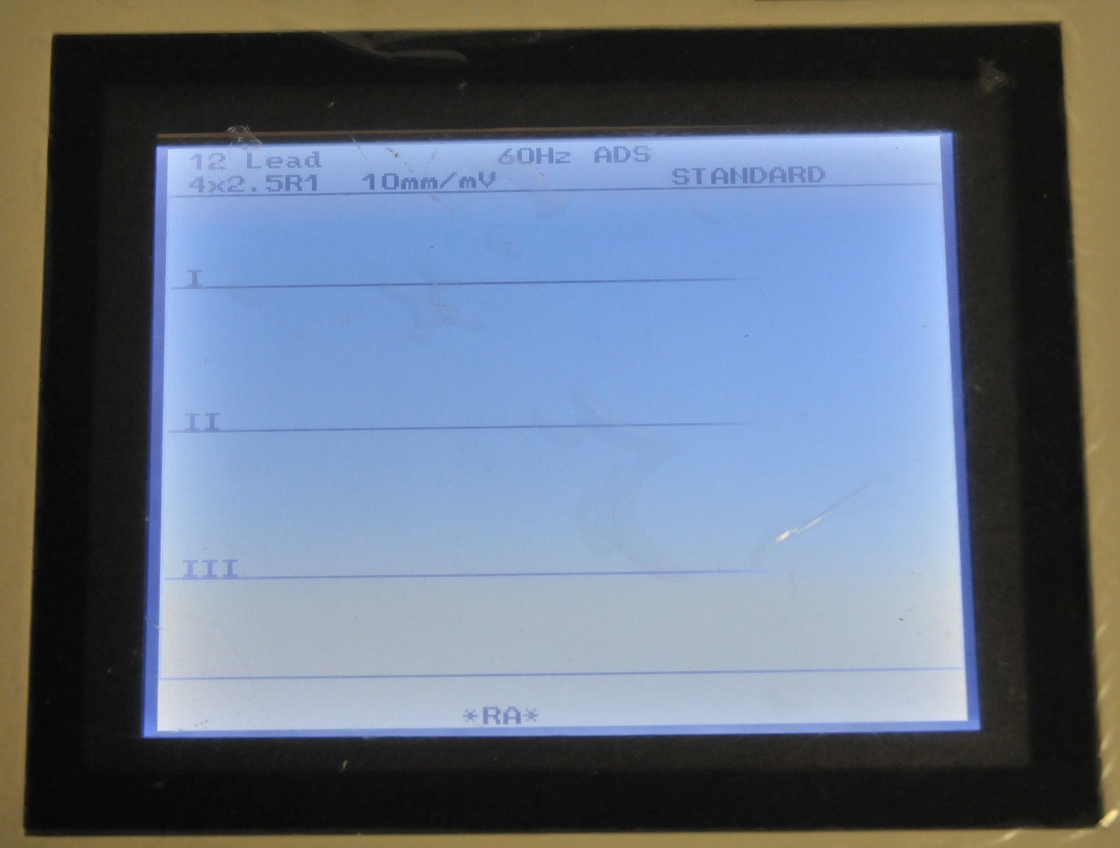 MAC 1200 General Electric EKG Electrocardiograph GE MAC1200 101116823 2007