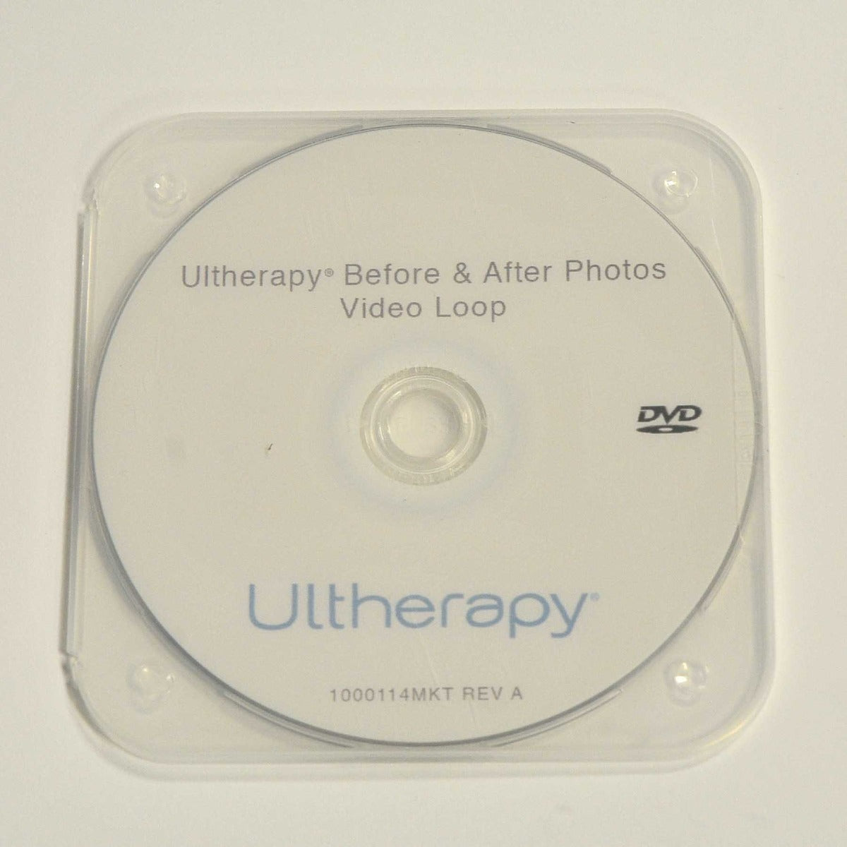 Ulthera Ultherapy Patient Waiting Room Before After Photos Video Loop DVD