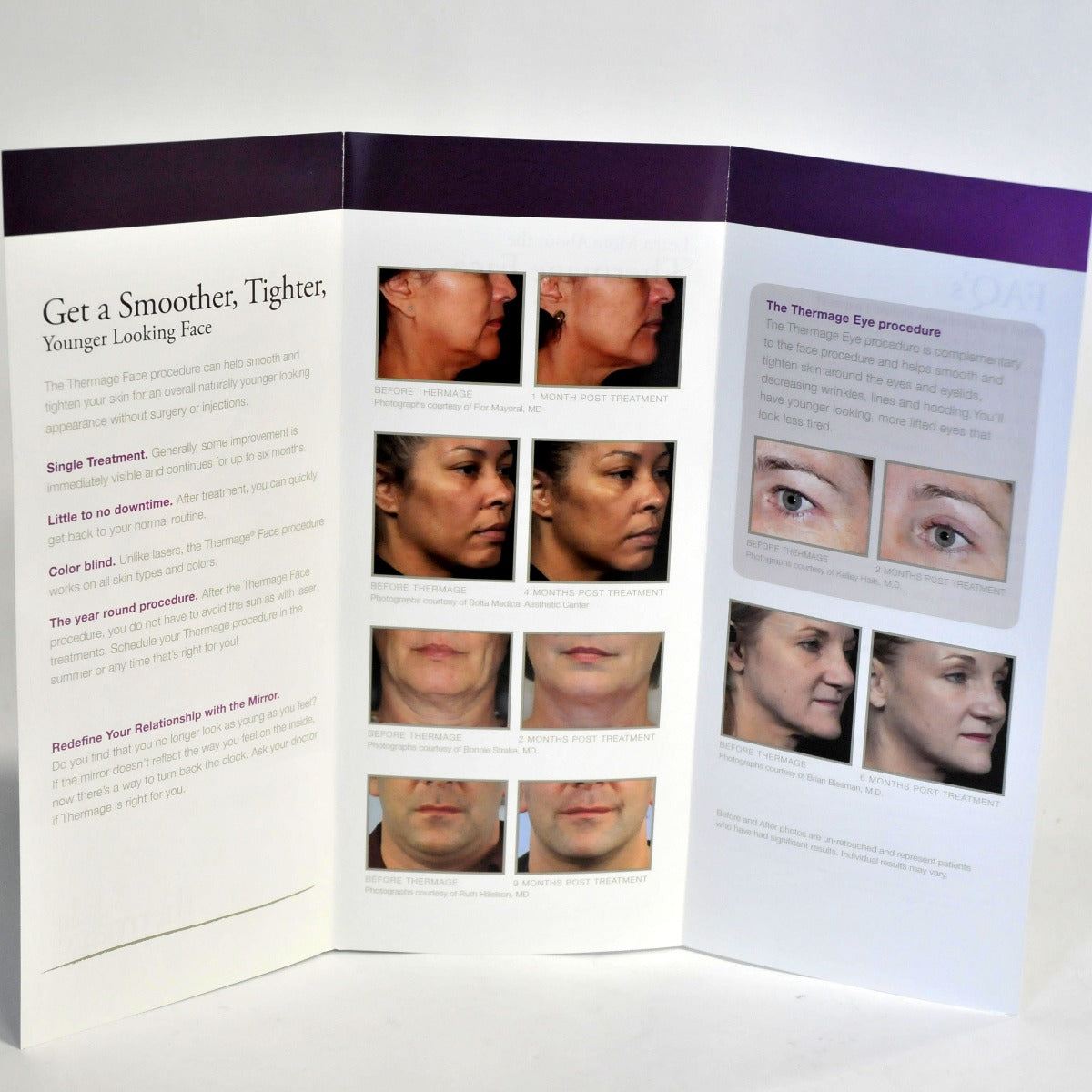 Solta Thermage Skin Tightening Contouring Office Brochure Put Best Face Forward