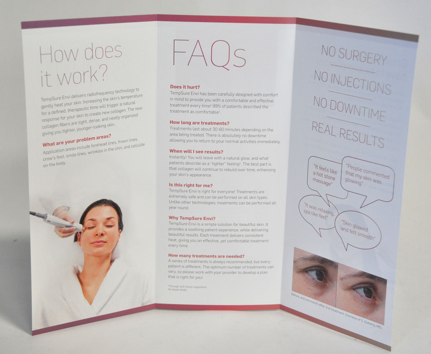 Cynosure TempSure ENVI Office Patient Marketing Brochure 921-7027-005 x48Pcs New