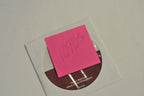 Solta Medical Fraxel Patient Seminar Before After Photo Office Marketing MK5049A
