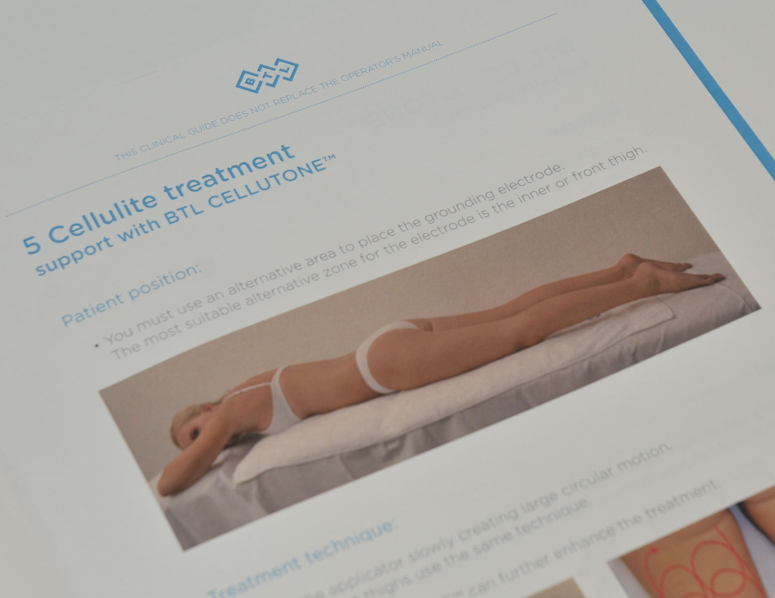 BTL Aesthetics CLINICAL GUIDE Exilis Ultra 360 Patient Applicator Treatment