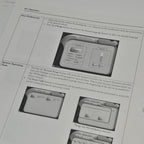 Lumenis LightSheer Duet Diode Laser System OPERATOR MANUAL User Guide Treatments