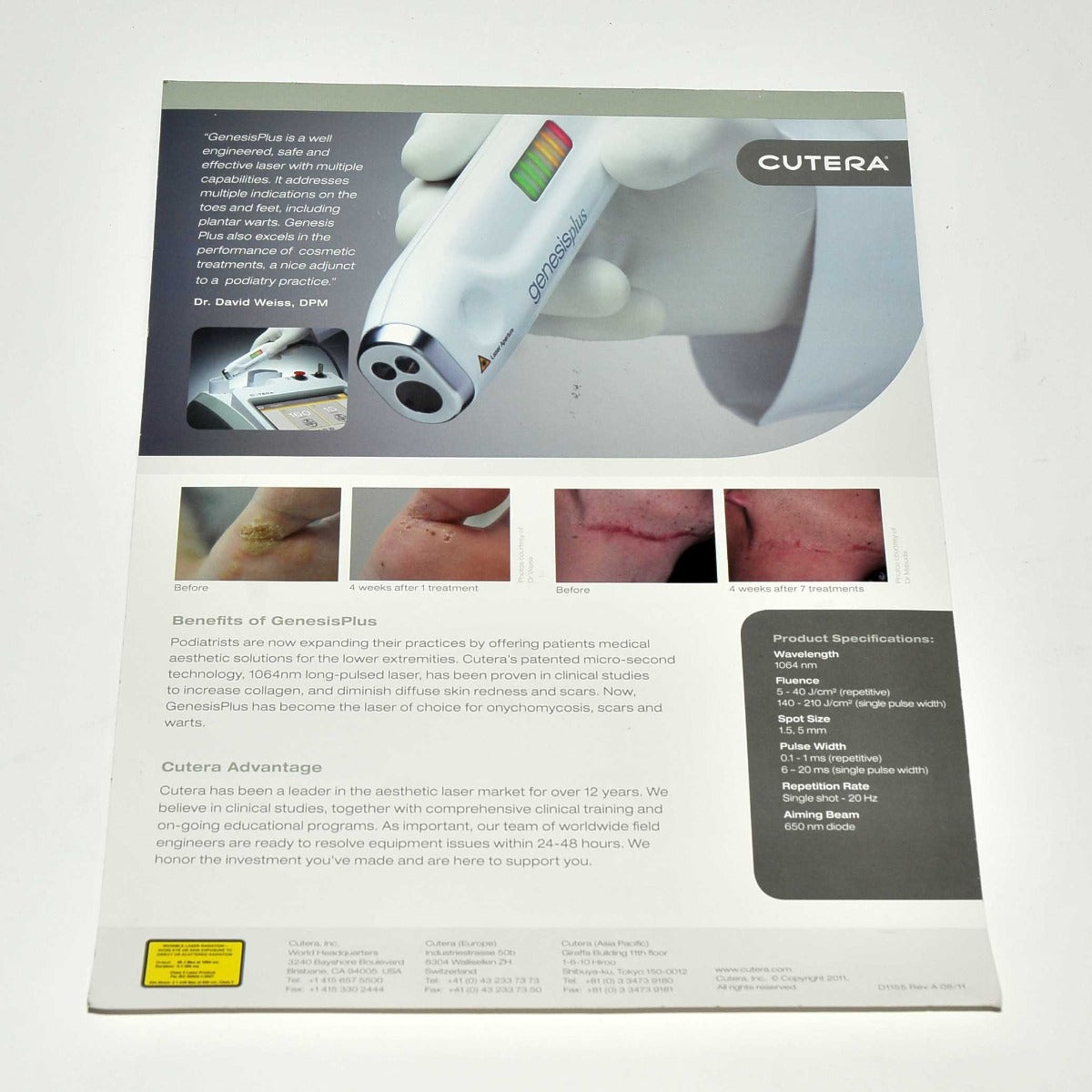 Cutera Laser Genesis Plus Feet Toes Onychomycosis Scars Warts Podiatry Brochure