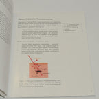 Cutera Laser Patient Questions to Ask Brochure Hair Removal Office Marketing