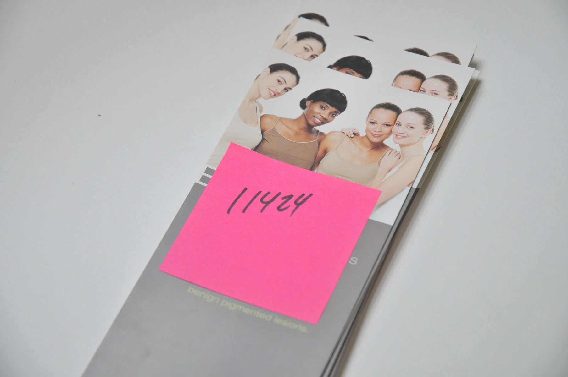 Cutera Excel V Laser BROCHURE Facial Leg Veins Office Marketing Patient ExcelV