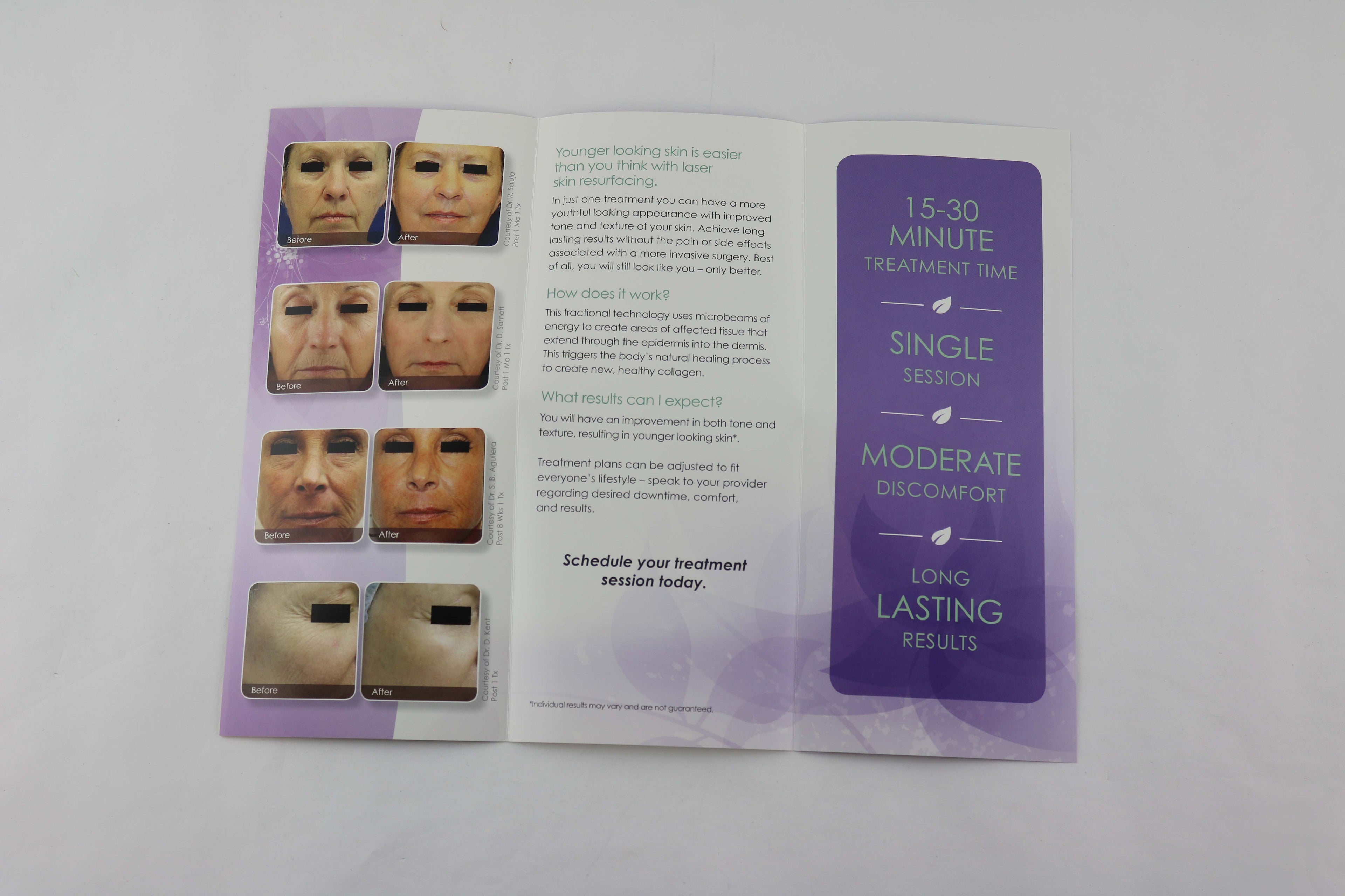 Cynosure ICON Remove Signs Aging Laser Skin Resurfacing Patient Brochures 12pk