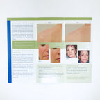 Red & Blue Light Therapy "Promote Healthy Skin" Brochure (92-Pack)