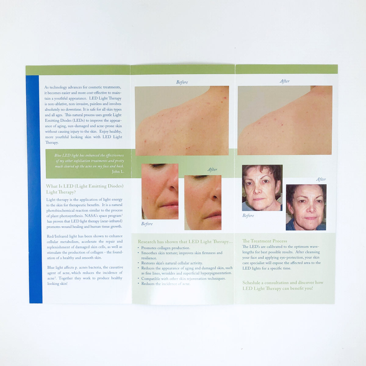 Red & Blue Light Therapy "Promote Healthy Skin" Brochure (92-Pack)