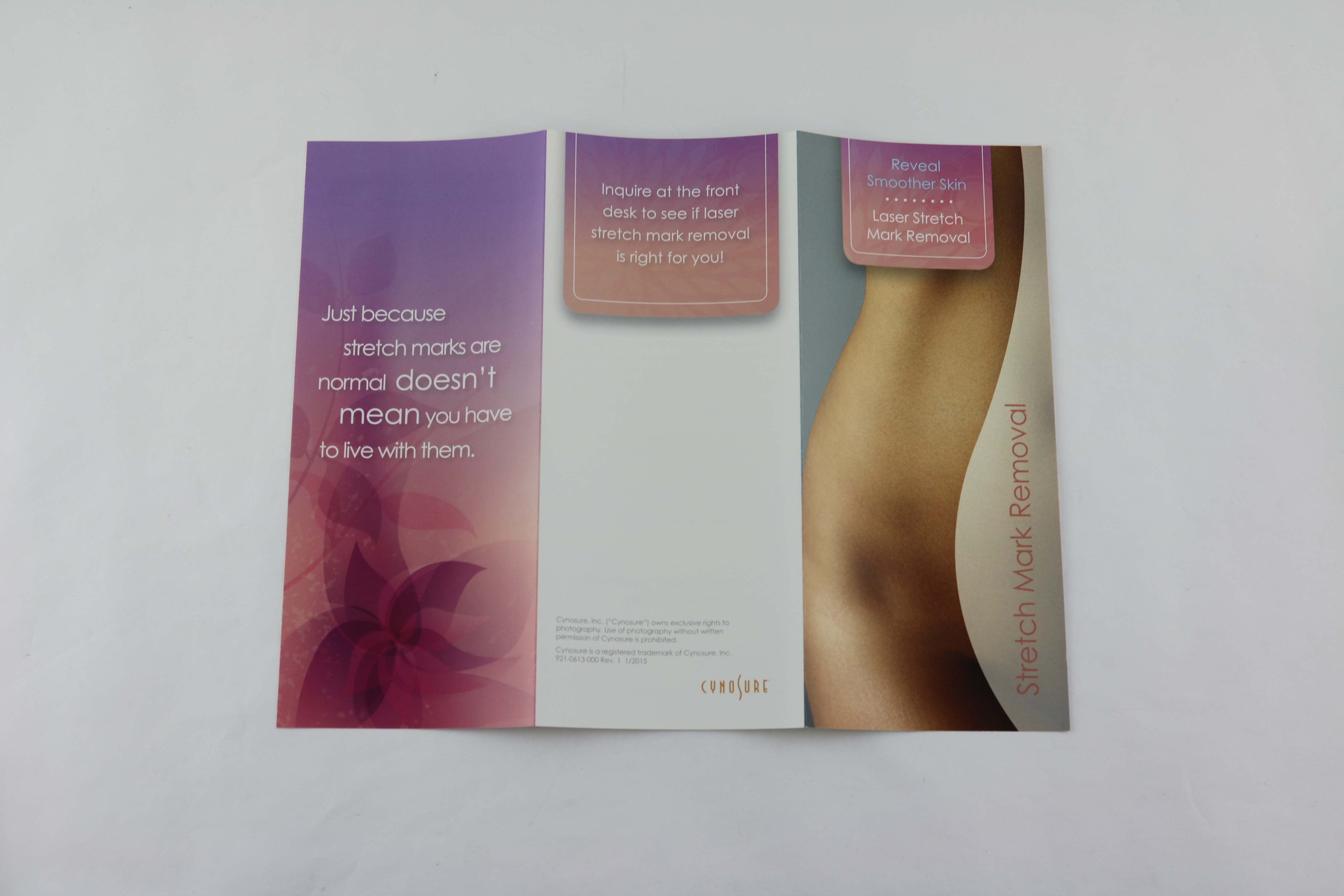 Cynosure ICON Smooth Skin Laser Stretch Mark Removal Patient Brochures 83pk