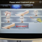 2018 Fotona SP Dynamis Pro Skin Acne Scar Nd:YAG Er:YAG Laser System M021-4AF/3