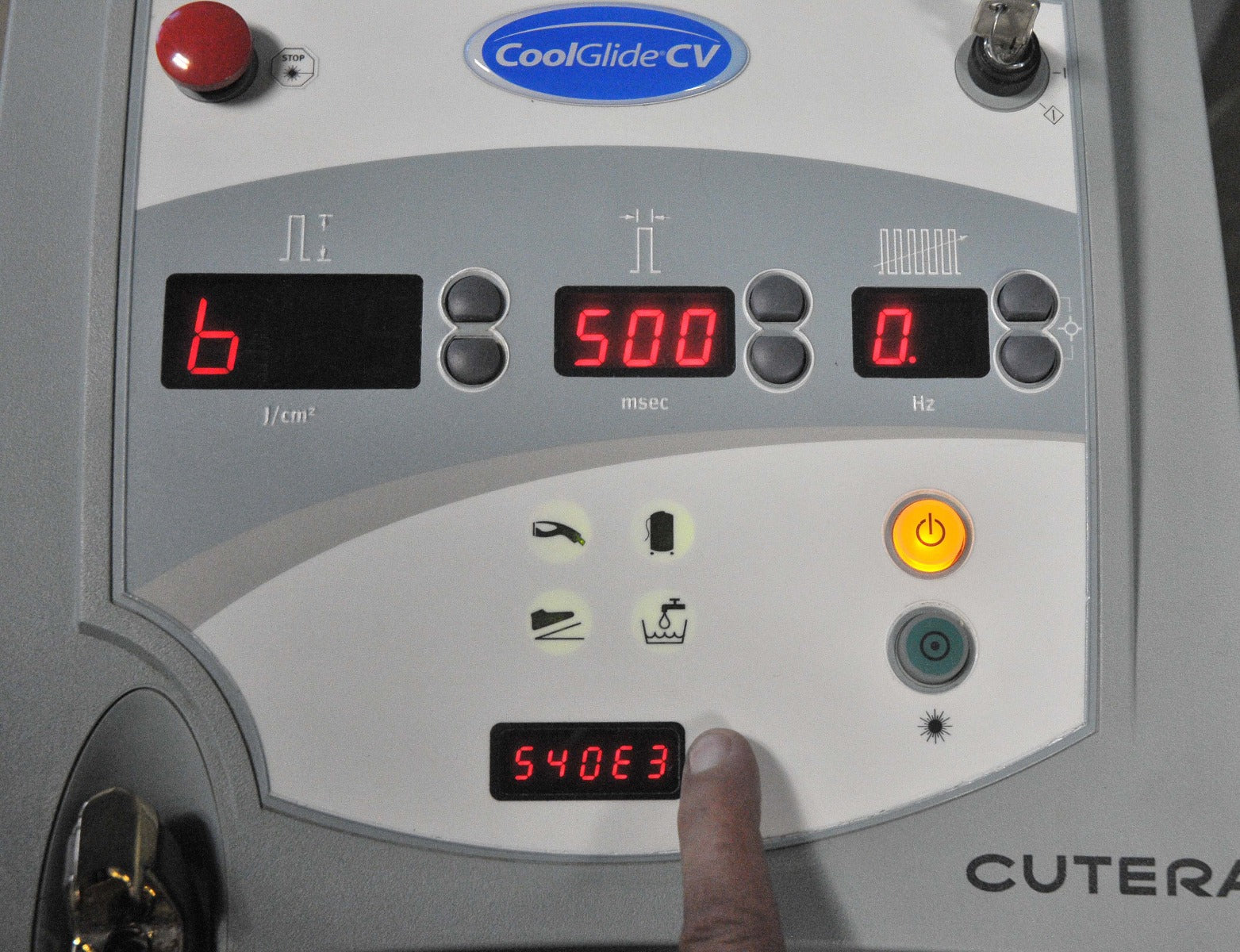 2006 Cutera CoolGlide CV Long Pulse Laser Nd:YAG 1064nm Hair Removal HR