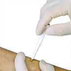 Acuderm - BIOPSY PUNCH