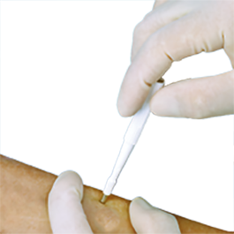 Acuderm - BIOPSY PUNCH