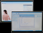 Fotofinder Mediscope Imaging System Digital Photography Camera Laptop Veinscope