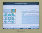 Solta Medical LIPOSONIX System Model 2 Focused Ultrasound Device Lipo Sonix 2012