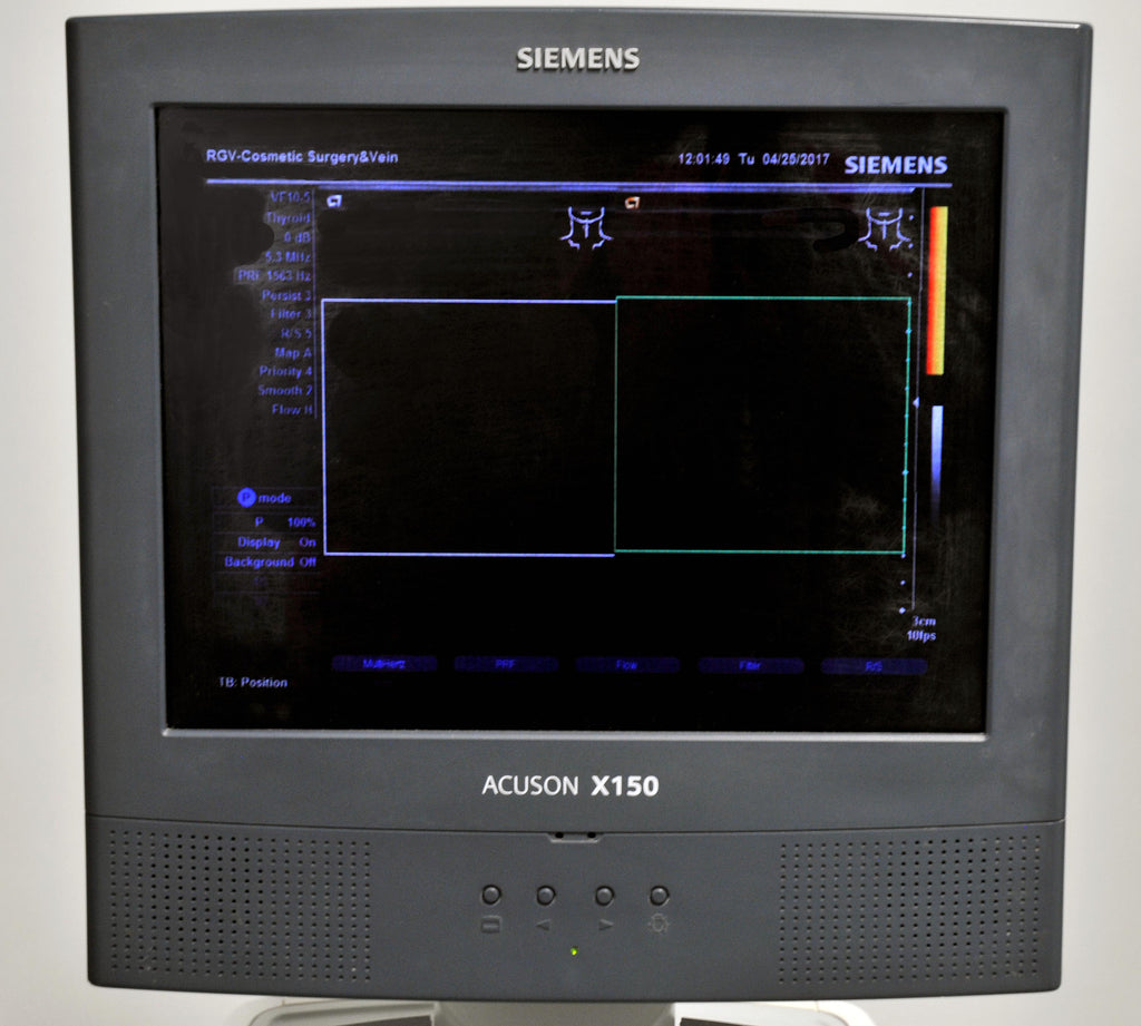 Siemens ACUSON X150 Ultrasound Sonogram Doppler Imaging Pulsed Wave System X 150