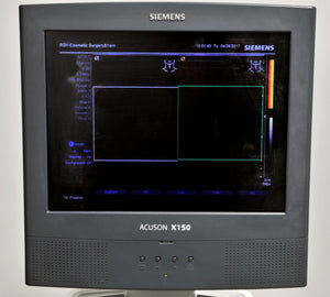 Siemens ACUSON X150 Ultrasound Sonogram Doppler Imaging Pulsed Wave System X 150