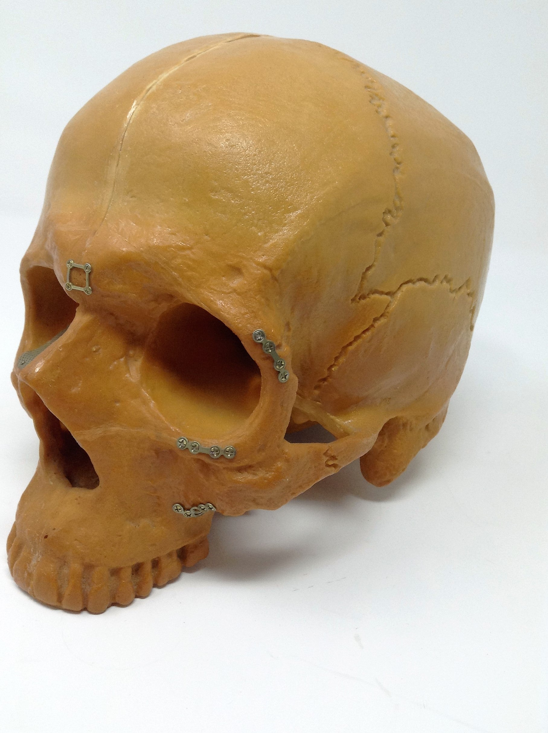 Sawbones Human Skull Replica For Medical Training & Education Cranium Head