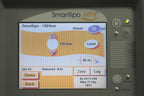 2008 Cynosure SmartLipo MPX 20W Nd YAG Laser 1064 nm Facial Leg NO RFID REQUIRED