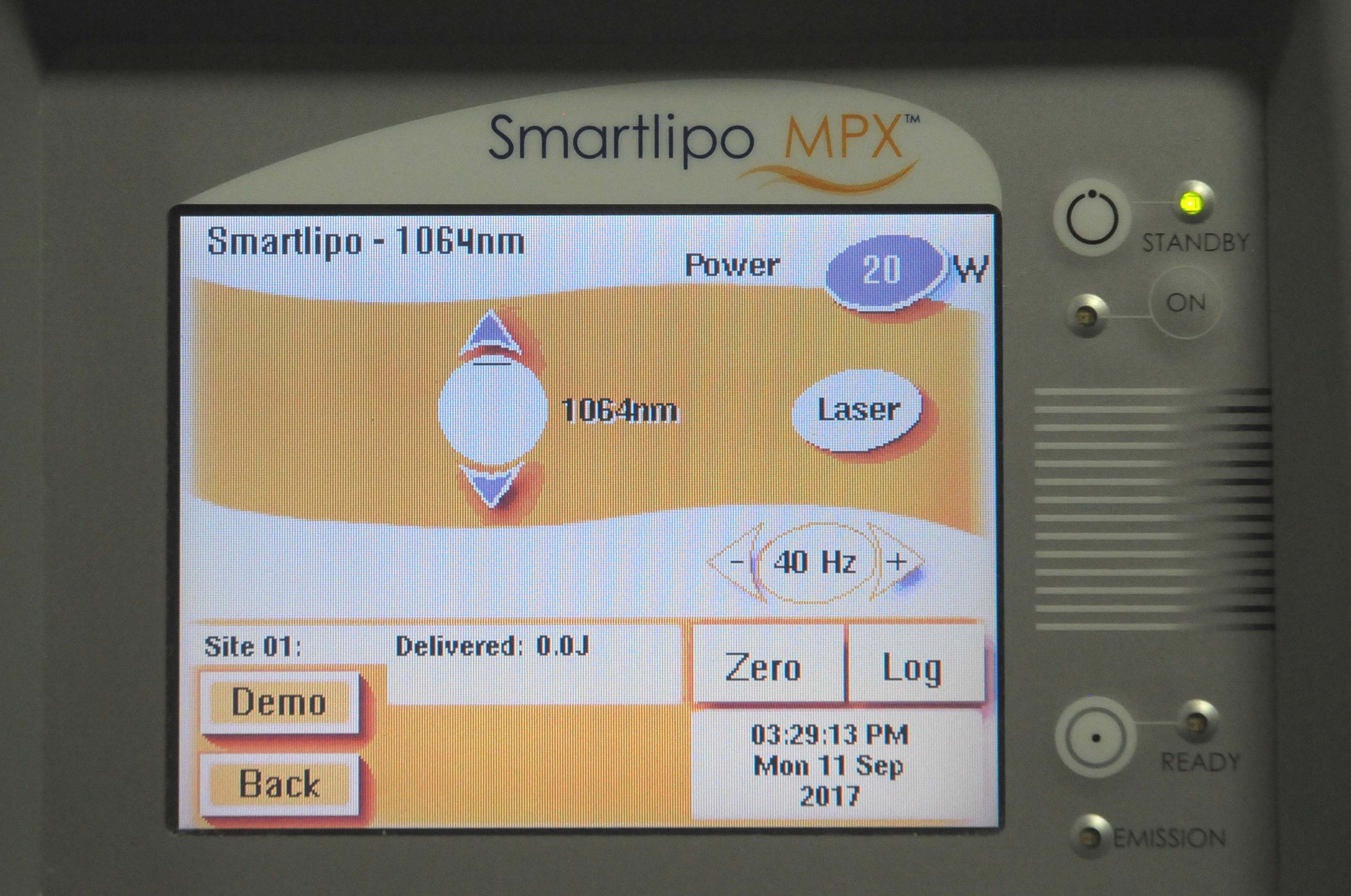 2008 Cynosure SmartLipo MPX 20W Nd YAG Laser 1064 nm Facial Leg NO RFID REQUIRED