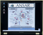 Ansar ANX 3.0 Autonomic Nervous System Patient Monitoring Nightingale PPM2 wCart