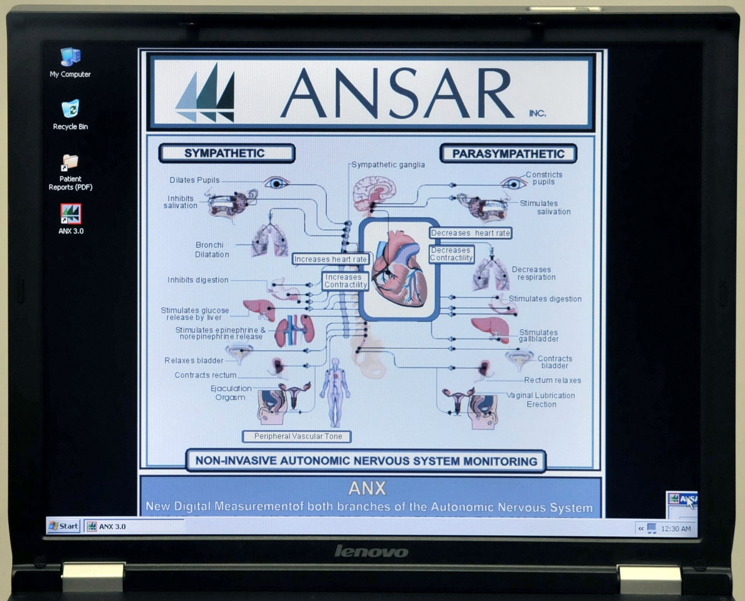 Ansar ANX 3.0 Autonomic Nervous System Patient Monitoring Nightingale PPM2 wCart